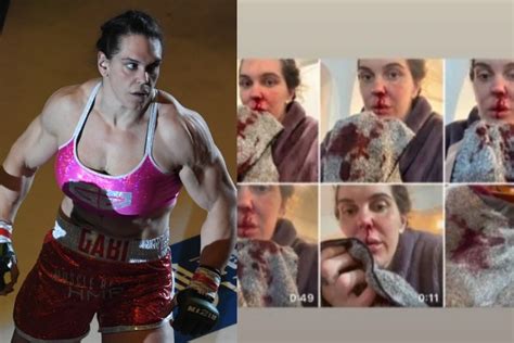 Gabi Garcia Gives More Details on Domestic Abuse。